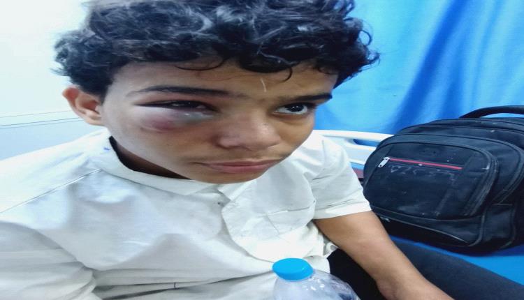 أفارقة يعتدون بوحشية على طفل في المكلا.. ومنشور مؤلم لوالده من خارج اليمن
