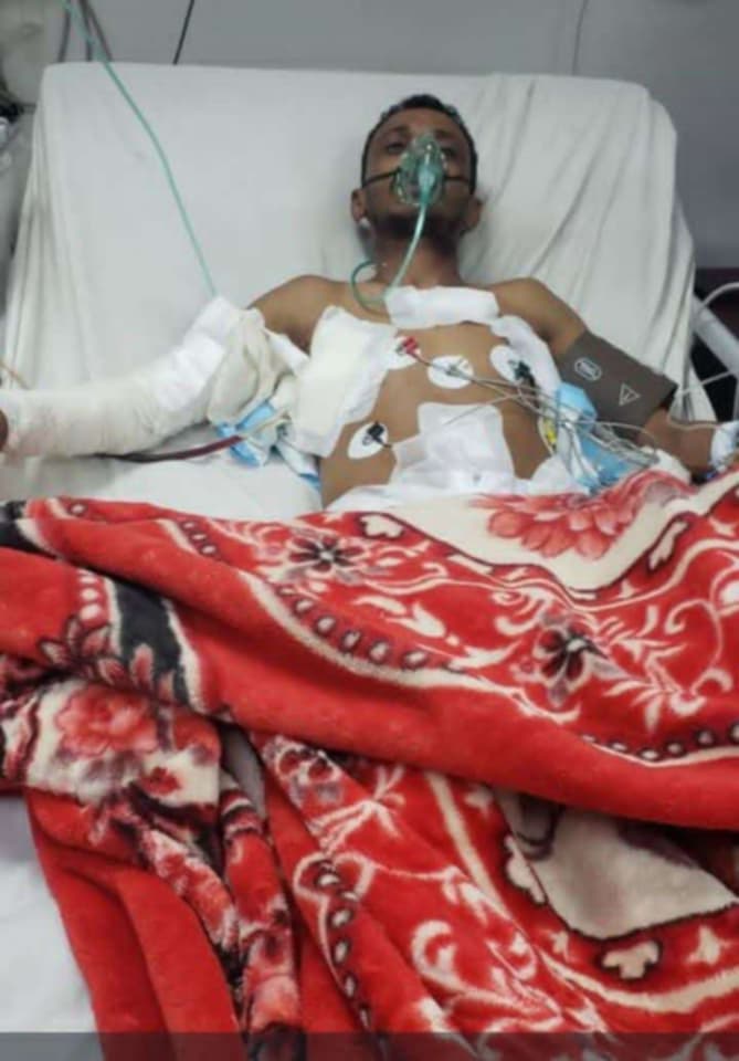 بطل الكونغ فو ينجو من قصف صاروخي في صنعاء ويستمر في رحلة التعافي