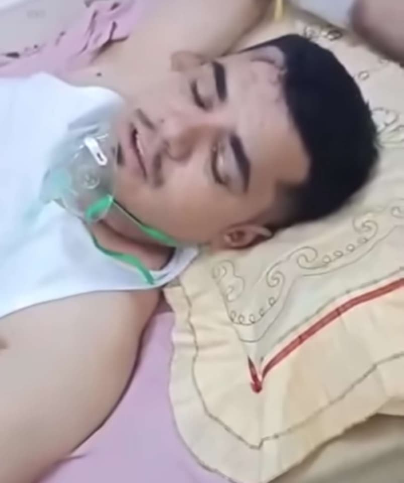 ناجي من باص أبين المحترق يكشف تفاصيل مرعبة عن الكارثة ومشكلات فنية قاتلة