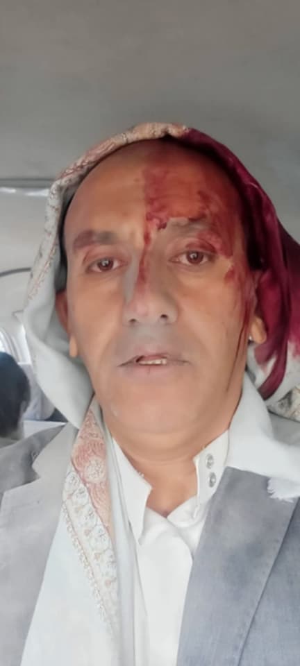 إعلامي ينجو من قصف جوي على صنعاء وسط ارتفاع حصيلة الضحايا