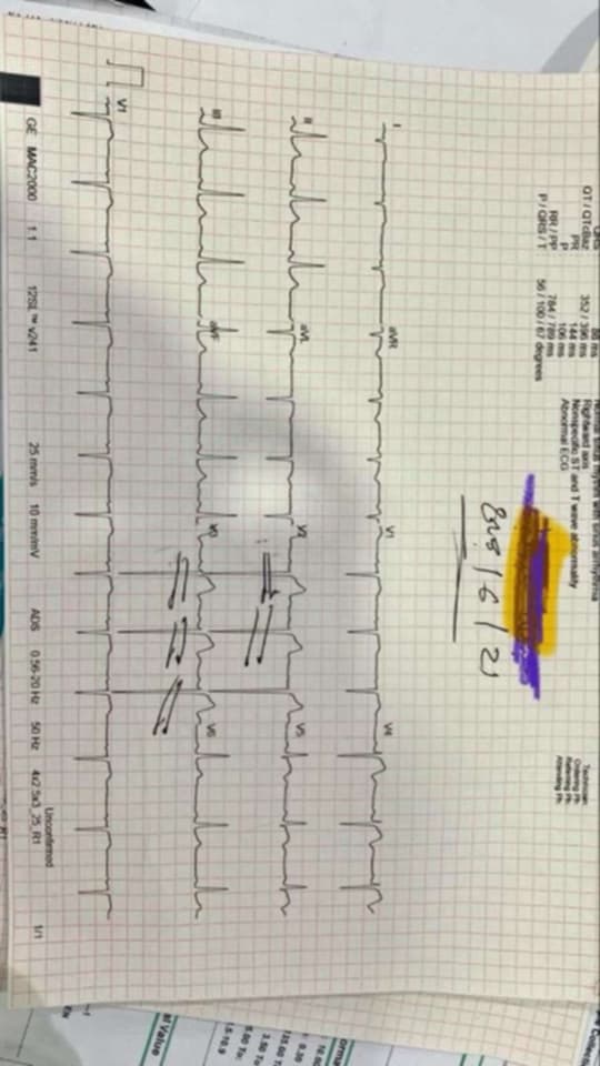 استشاري قلب يمني يكشف مادة قاتلة تتسلل للأسواق دون رقابة