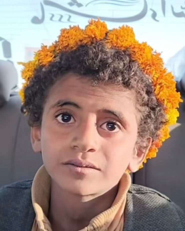 صورة لطفل يمني تُثير تعاطفًا واسعًا.. القصة الكاملة وراء الانتشار